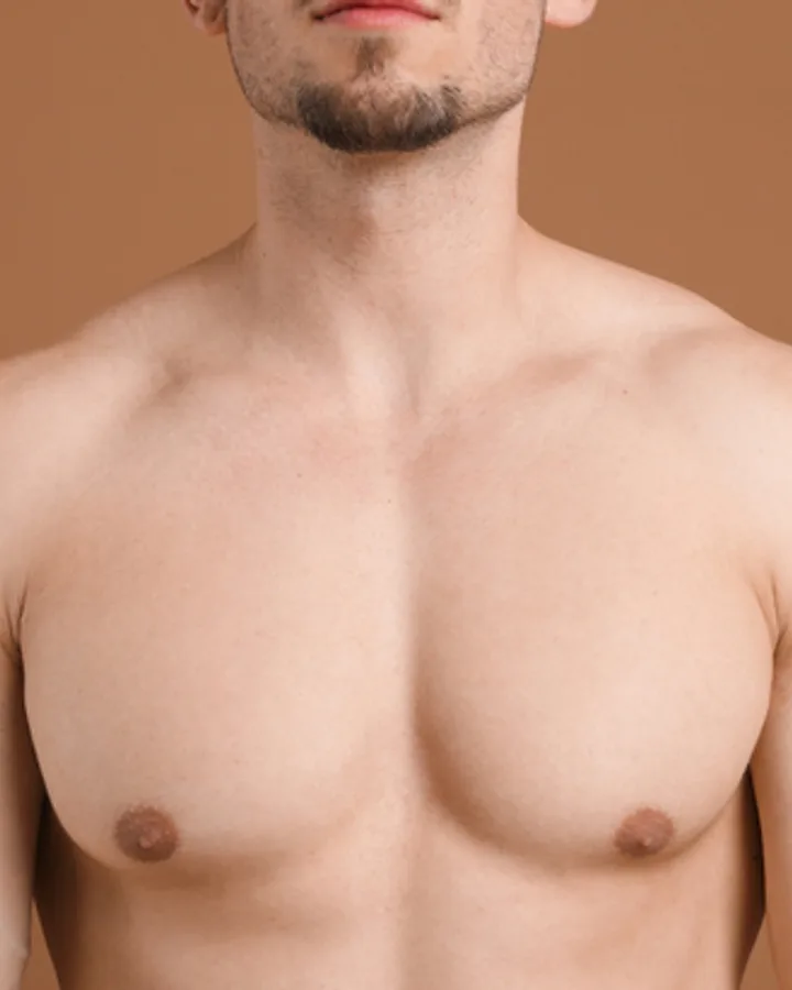 Brust — after OMEGA laser hair removal