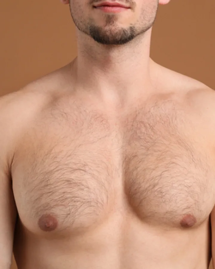 Brust — before treatment