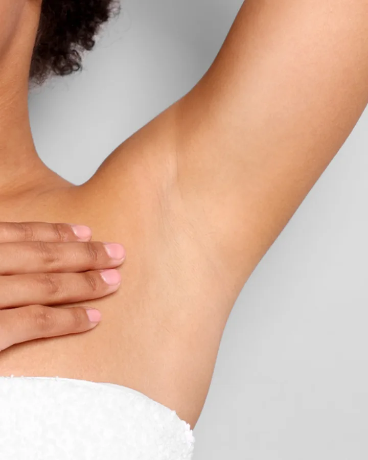 Achseln — after OMEGA laser hair removal